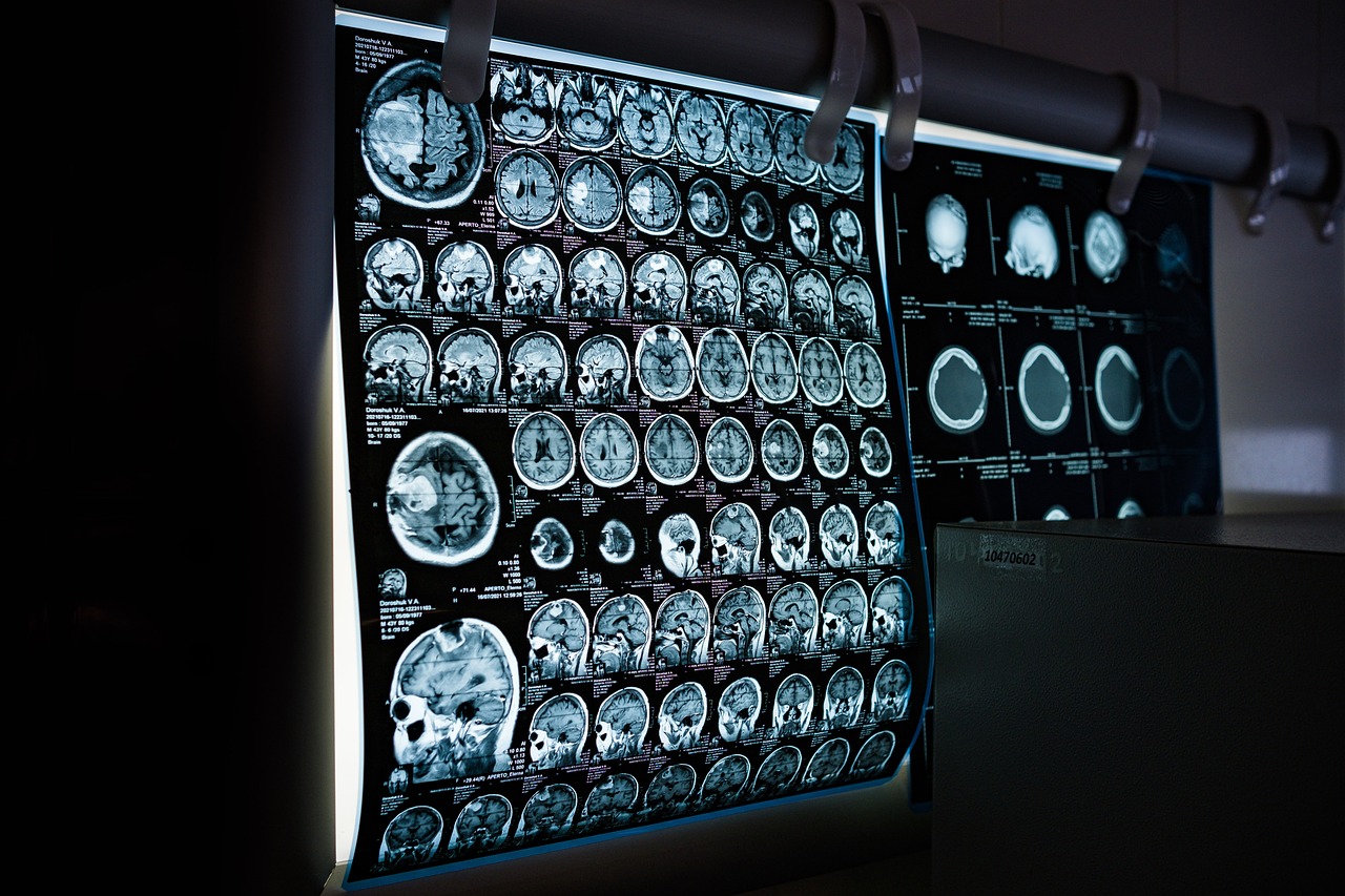 X Ray G66ac8cae8 1280